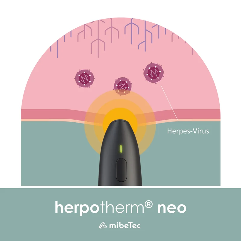 mibeTec herpotherm® neo